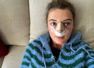 Jamie-Lee Six bijna flauwgevallen na operatie